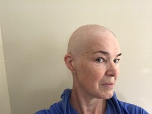 IMG 4677 300x225 - 56 days slow and bald
