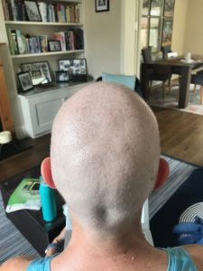 56 days slow and bald IMG 4681 225x300 - 56 days slow and bald